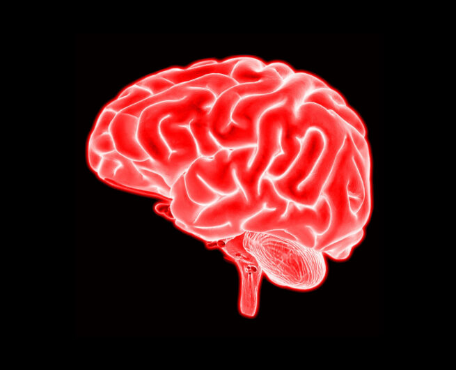 red-brain